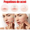 200PCS Parches para Acne,Pimple Patch, Parches para Espinillas, Almohadillas Hidrocoloides
