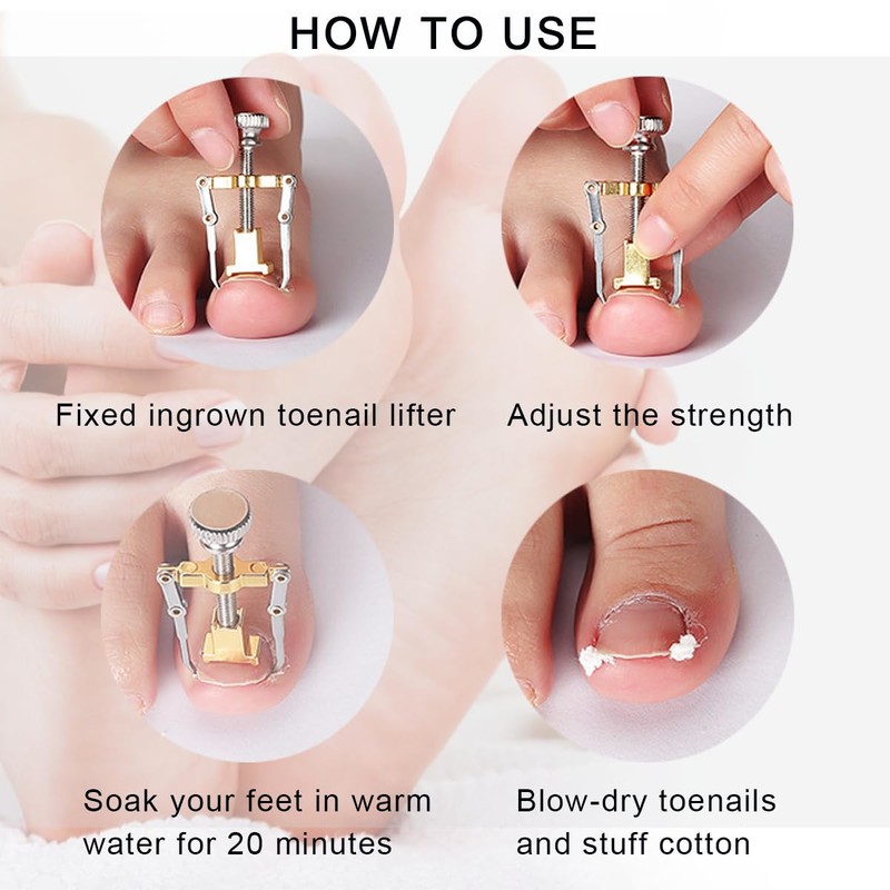 77 Pieces Ingrown Toenail Tool Set, Include Ingrown Toenail File