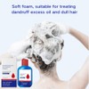 2 Pcs Anti-Dandruff Shampoo, Oil Control and Refreshing Formula, Hair