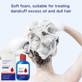 2 Pcs Anti-Dandruff Shampoo, Oil Control and Refreshing Formula, Hair Care Cleansing Shampoo, Nourishment for Men and Women (240ML)