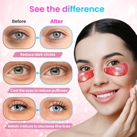 Onespring Onespring Eye Masks (36 Pairs) - Under Eye Patches for Relieves Dark Circles, Fine Lines and Puffiness, Revitalizing Eye Gel Pads - Ideal for Daily Skin Care & Gift Choice
