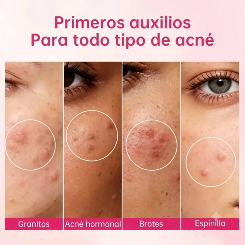 Sérum Bifásico Antiacné Puntos Rojos Y Espinillas Noche Weud