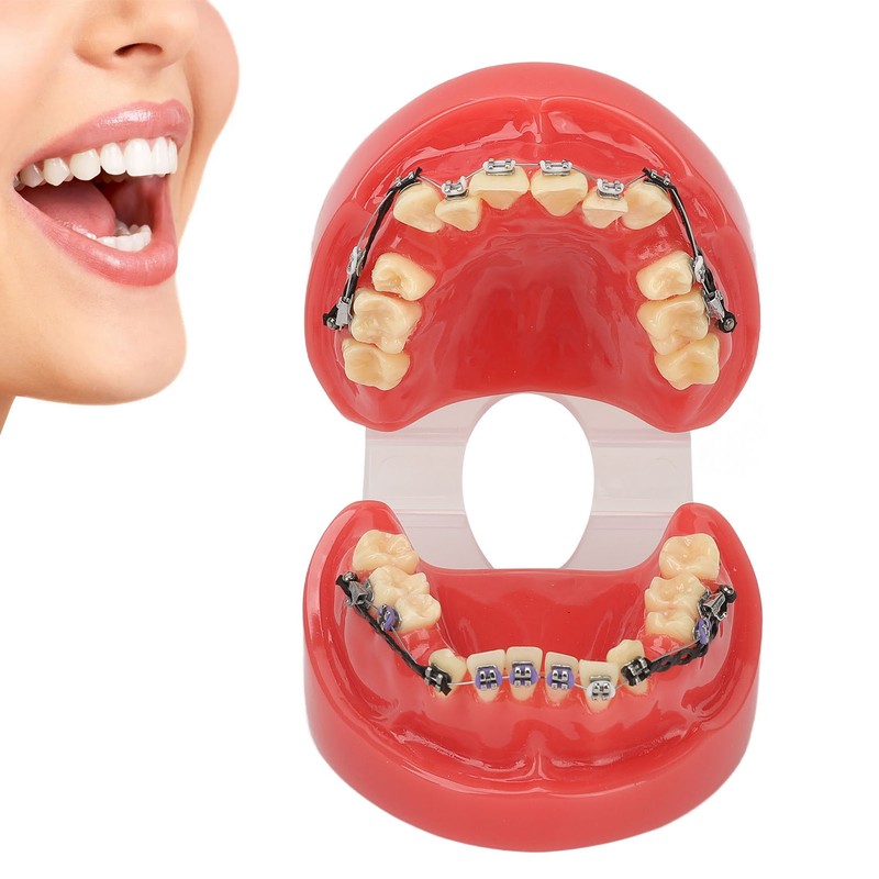 Professional Dental Demonstration Orthodontic Model with Metal Wires and Bracket