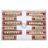 Resin Tooth Acrylic Resin Denture Teeth Dental Resin False Teeth