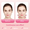 V Line lifting Mask Facial Slimming Strap - Double Chin