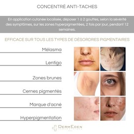 DermEden - TXA Concentrado Antimanchas 3x10 ml - Elimina y reduce la aparición de manchas pigmentarias - Regula el proceso de melanogénesis - Textura 