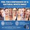 MILTODENT Sensitive Teeth Whitening Strips (40pcs) - White Strips for
