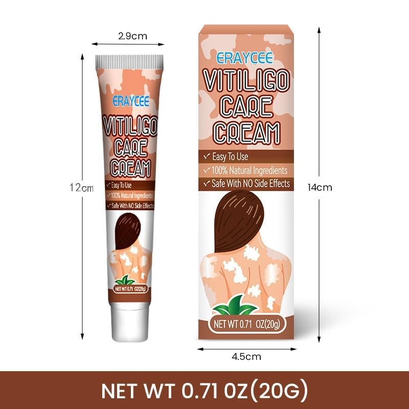 Vitiligo Cream, Natural Effective Vitiligo Treatment for Reduce White Spots