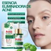 Pack 4 Serum Antienvejecimiento Ácido Hialuronico Facial Tipo De Piel