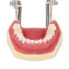 Periodontal Disease Teeth Resin Model Dental Demonstration Teeth Model for