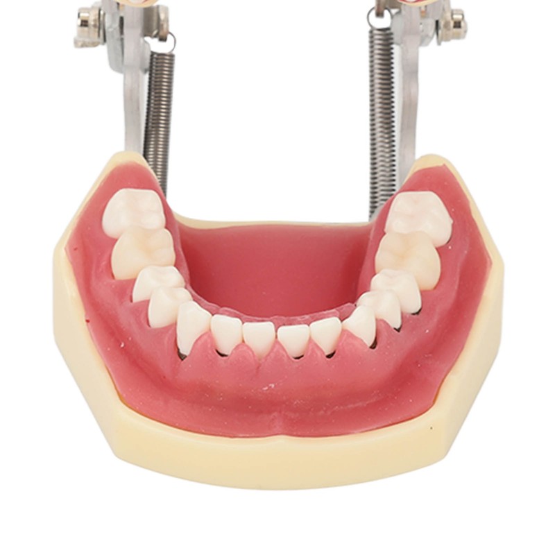 Periodontal Disease Teeth Resin Model Dental Demonstration Teeth Model for