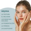 Abera Melasma Srum, Suero Facial Despigmentante, Tratamiento para Melasma y