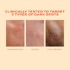 Murad Rapid Dark Spot Correcting Serum - Environmental Shield -