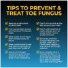 Fungi Nail 1oz Solution, With Brush