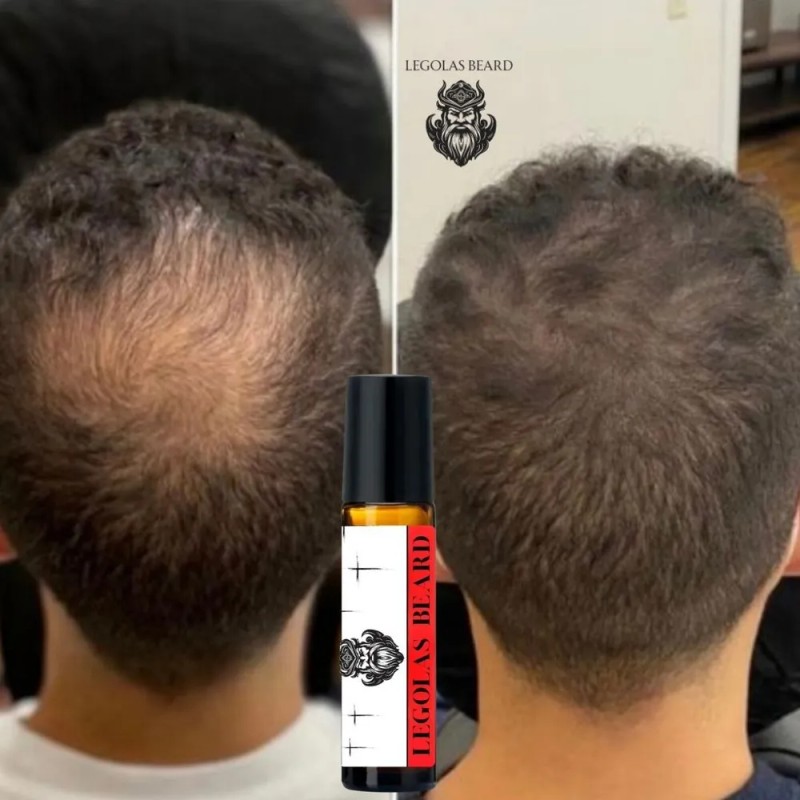 Bálsamo Para Crecimiento De Barba, Cierra Huecos Y Alopecias Cítrica