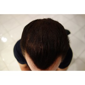 Finally Hair Keratin Hair Building Fibers for Hair Thickening Fiber Hair Loss Concealer. (Dark Grey & Pepper)