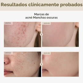 TOSOWOONG - Suero de arroz 2 %, alfa arbutina, arroz 746,074 ppm, 33 ml/1.11 oz, alfa arbutina 20000 ppm, brillo, glass skin, para pigmentación, acné, manchas oscuras, tono uniforme, cuidado coreano