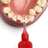 TEPE Interdental Brushes Red Original 0.5 mm/Simple and Effective Cleaning