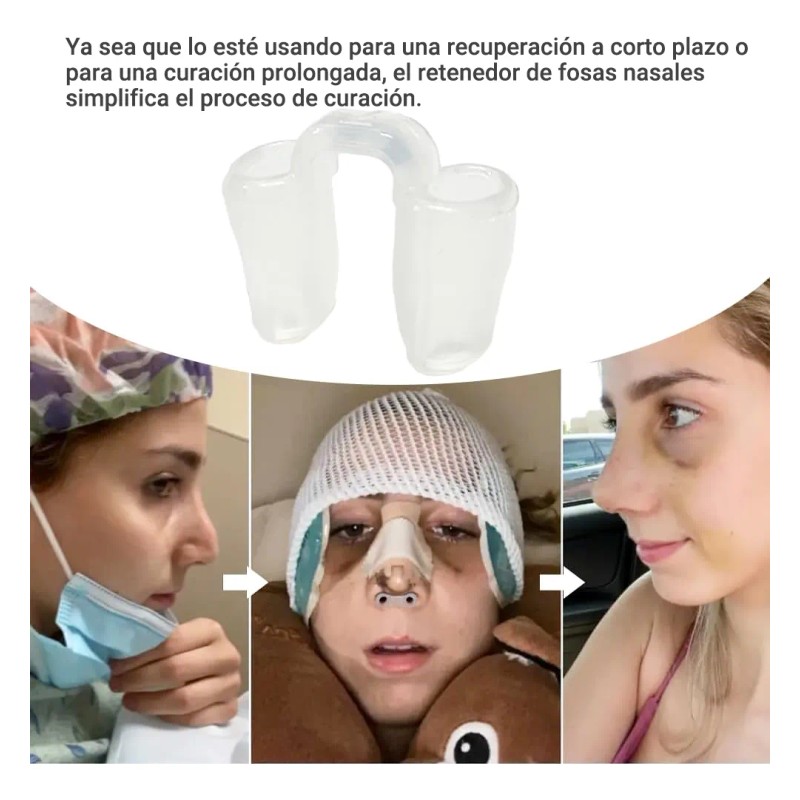 Kit 4pzs Retenedor Nasal Y Termoplástica Rinoplastia