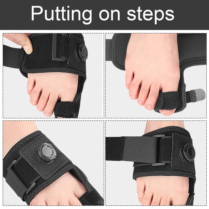 Hallux Valgus Correction, Hallux Valgus Correction Adjustable Button, Hallux Valgus