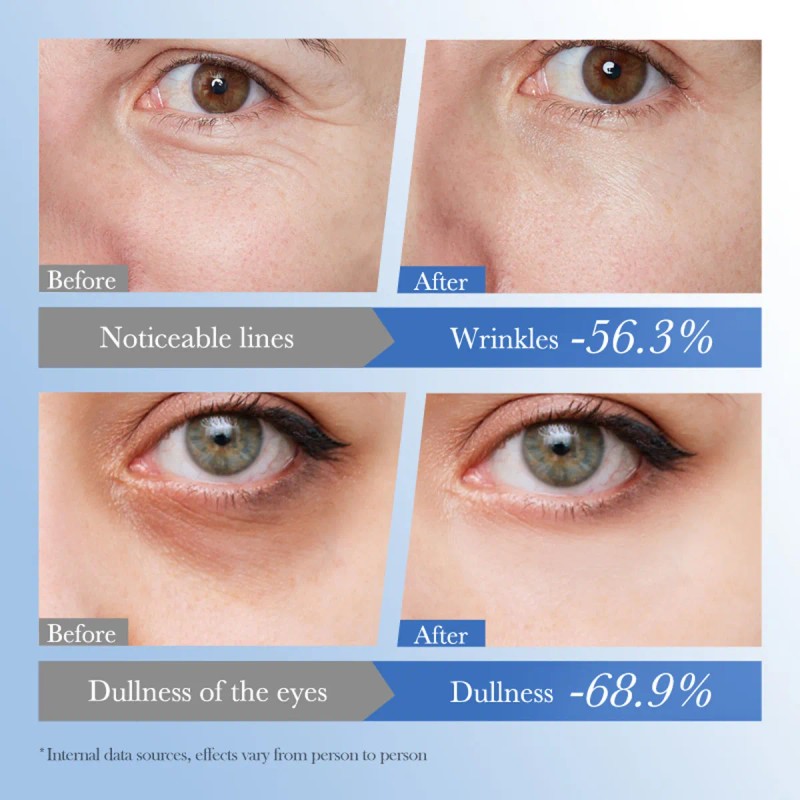 Crema Reafirmante Antiarrugas Para Ojos K Crema Hidratante P