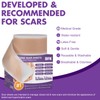 Silicone Scar Sheets, Silicone Scar Tape(1.6"x 79" Roll-2M), Reusable Professional
