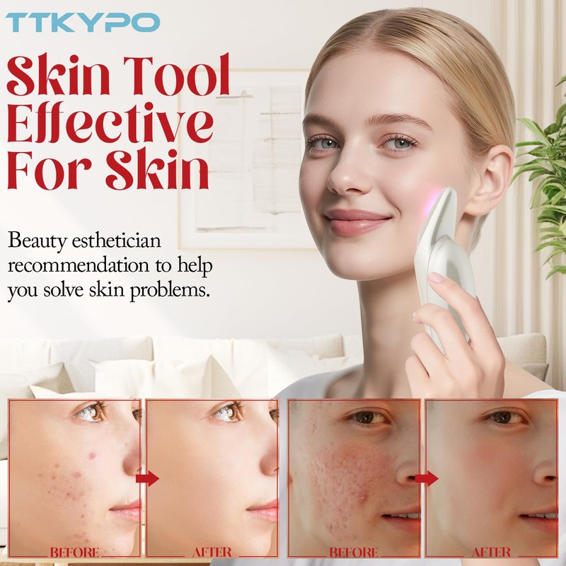 TTKYPO High Frequency Device for Face Skin Home Use