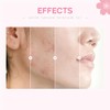 Etuanxi Set Cuidado Facial Kit Cereza Mujer Regalo Adolescentes Sets