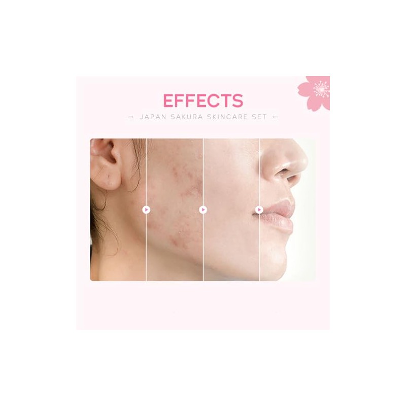 Etuanxi Set Cuidado Facial Kit Cereza Mujer Regalo Adolescentes Sets