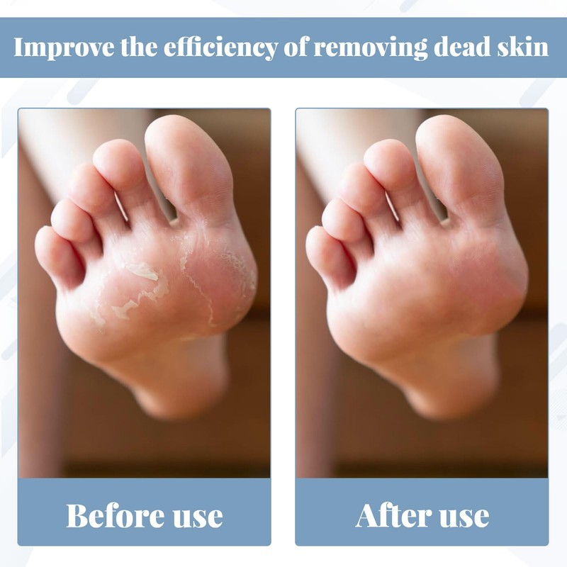 12Pcs Foot File Replacement Rollers for Flawless Pedi Include Extra