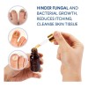 Tratamiento De Hongos En Las Uñas De Los Pies Extra