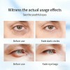 Rapid Reduction Eye Serum For Under-eye Bags & Wrinkles -