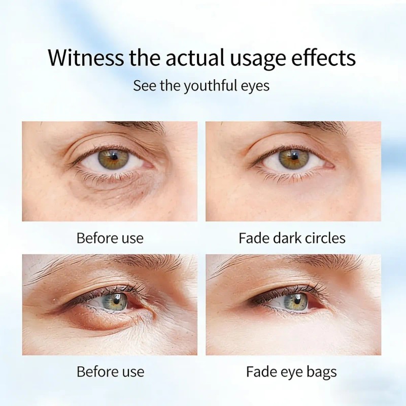 Rapid Reduction Eye Serum For Under-eye Bags & Wrinkles -