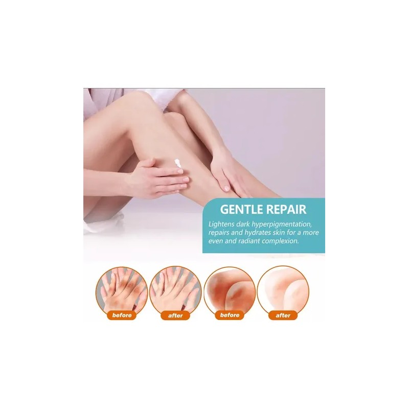Crema Para Acantosis Nigricans Fixderma Nigrifix, 3 Piezas