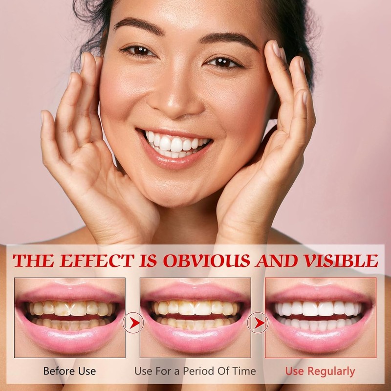 Super ProbioticSp-8 Toothpaste, SP-8 Toothpaste, SP8 Probiotic Toothpaste, SP-8 Ultra