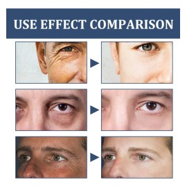 Crema Facial 6 En 1 Para Hombre, Crema Hidratante Para Jx