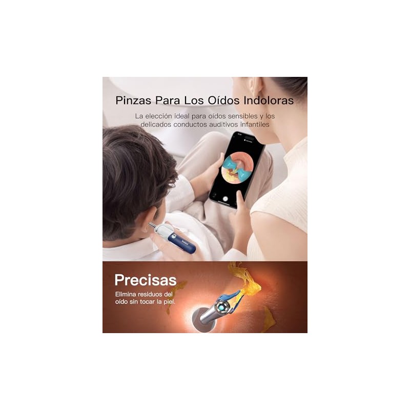 Bebird Limpiador de Oídos con Otoscopio Digital HD, Cámara Flexible,