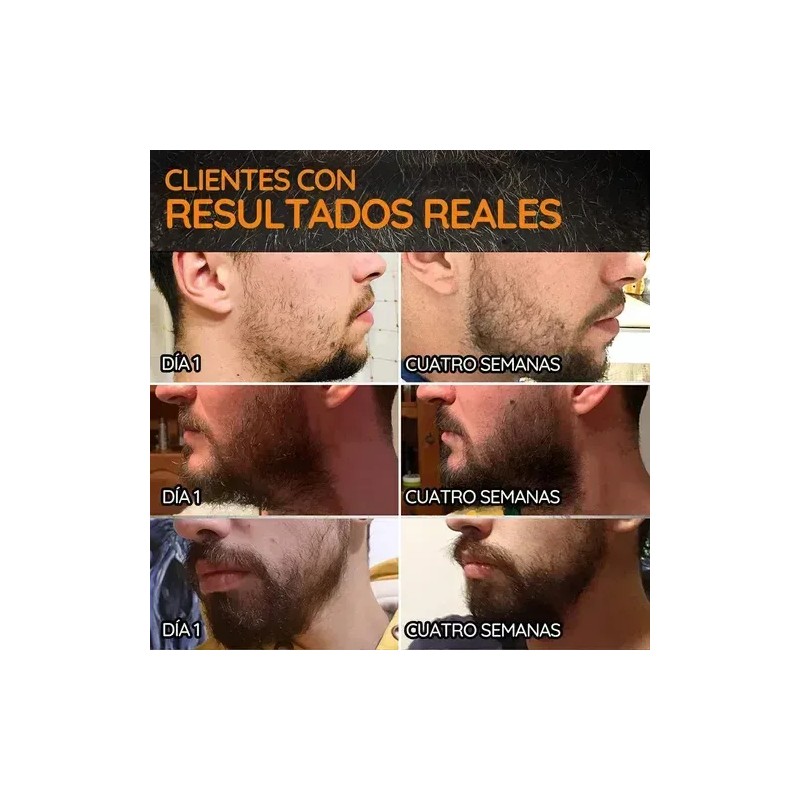 Kit Barba Serum Natural + Rodillo Micro Agujas Crecimiento