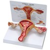 GPI Anatomicals W33352 Uterus Model