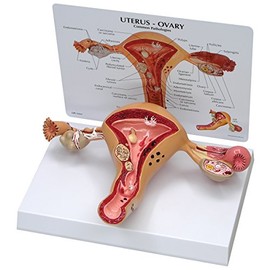 GPI Anatomicals W33352 Uterus Model