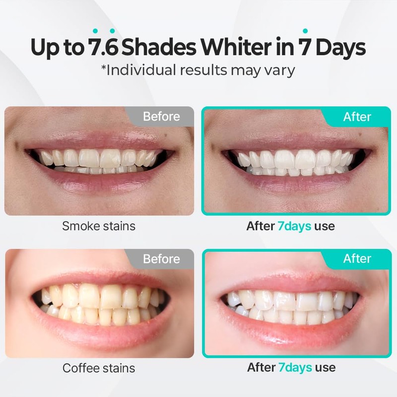 LiveOrals Puredia Whitening Toothpaste 80g – Fluoride-Free, Nano Hydroxyapatite &