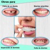 Dientes Postizos Temporal Falsos Carillas Dentales
