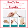 Silicone Scar Sheets (1.6” x 120” Roll-3M), Silicone Scar Tape