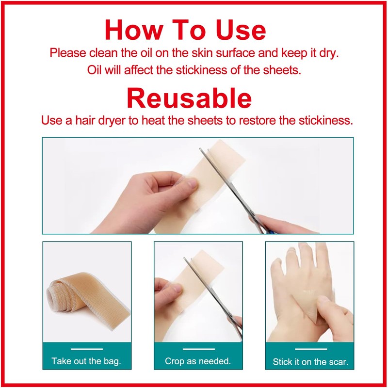 Silicone Scar Sheets (1.6” x 120” Roll-3M), Silicone Scar Tape