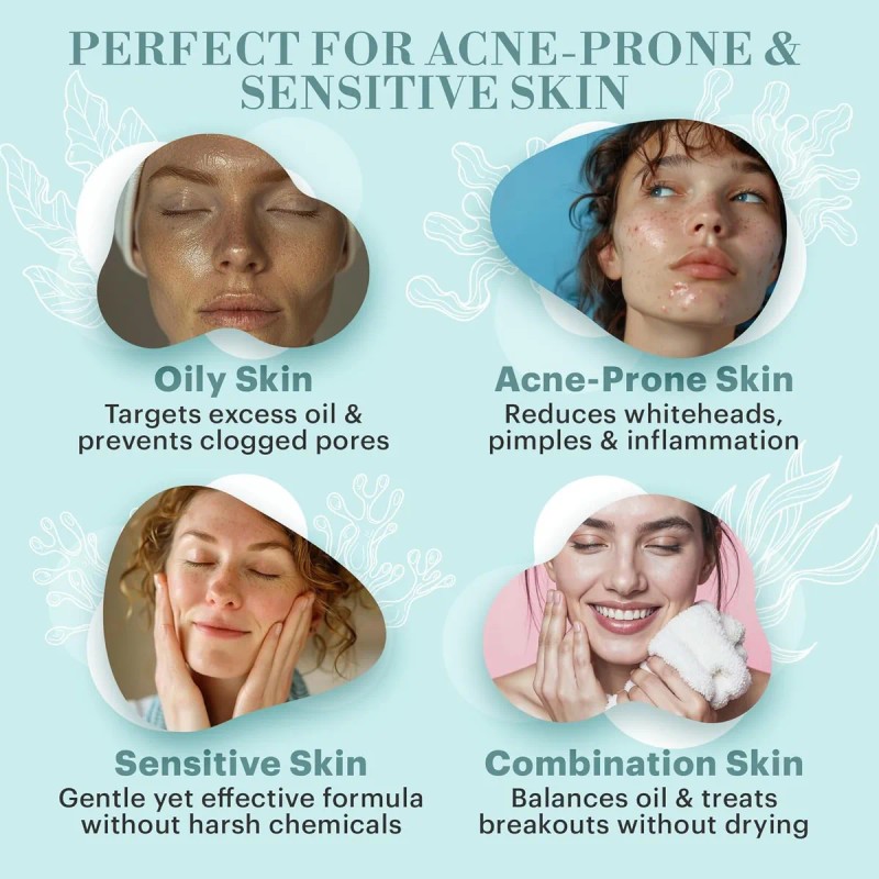 Repechage Tratamiento De Manchas De Acné Para Espinillas Bla