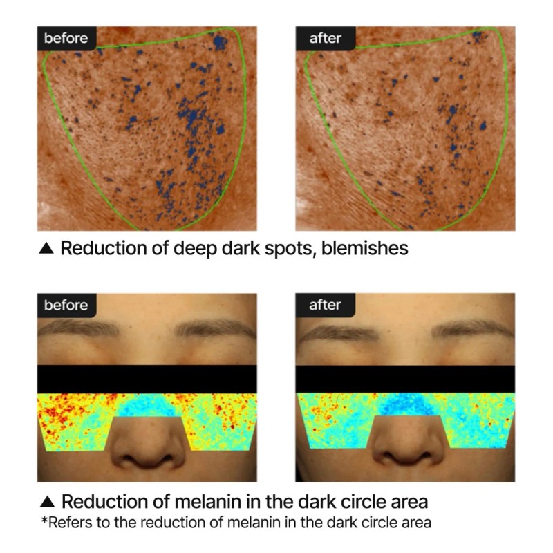 Pore Dark Spot Brightening Cream Non Irritating 35ml