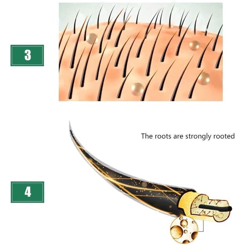 Tratamiento de pérdida de cabello Esencia de crecimiento del cabello