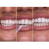 hismile Glostik Tooth Gloss 4ml