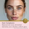Revitale Advanced Salicylic Acid Cream for Face & Body 80g