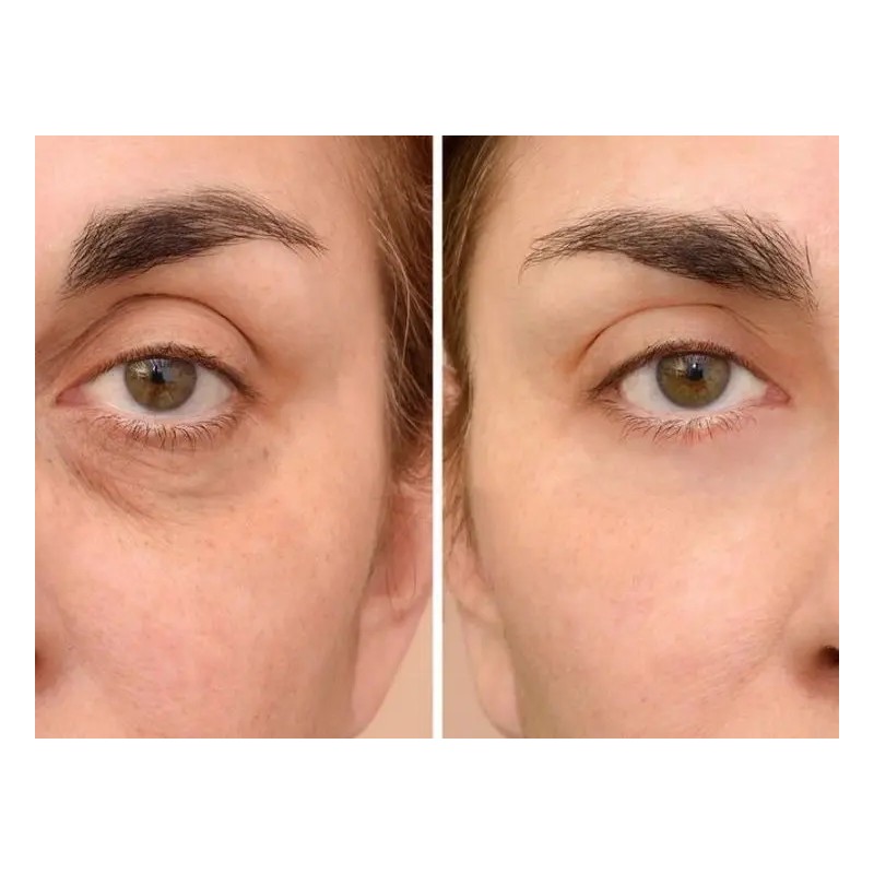 Suero Cafeína Antiojeras